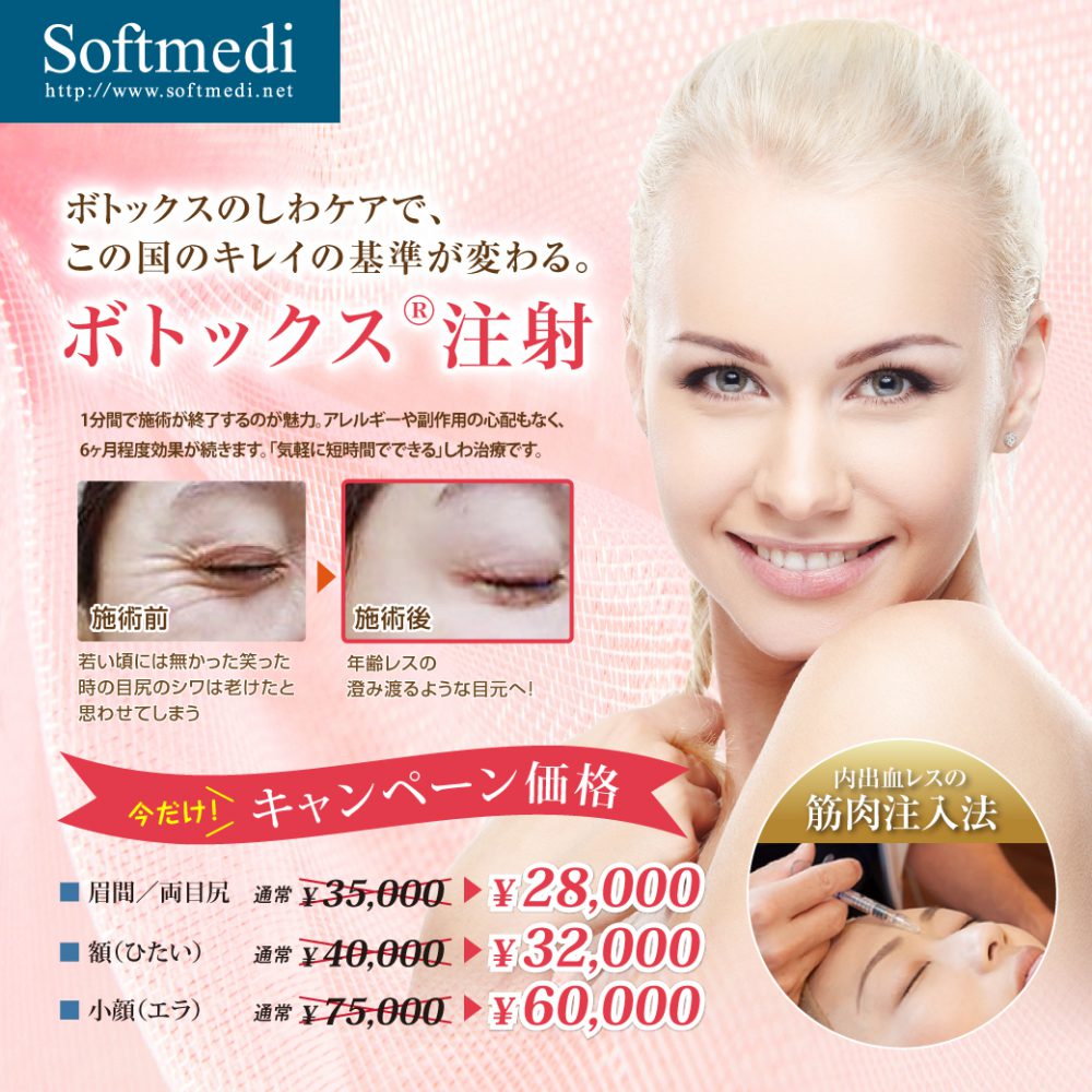 ボトックスで表情ジワ改善｜京都の山本クリニック ソフトメディ